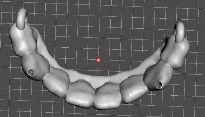 I vant to print your teeth! Bleh!