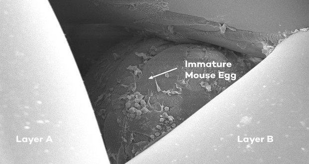3d printed ovary